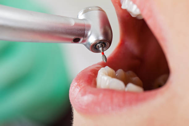 Best Emergency Dental Care for Trauma or Injury in Lyman, WY